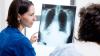 Australia’s New Lung Cancer Screening Enjoys High Uptake