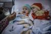 MSF: Big rise in the number of malnourished children in Afghanistan