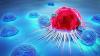 Cancer patients receiving government financial aid significantly rises in recent years