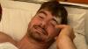 Insurance won't cover Brit after three-storey balcony fall on Portugal stag do as he'd been drinking