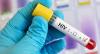 SVG sees spike in HIV among older men, young adults