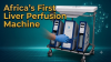 Africa's first liver perfusion machine launches in South Africa