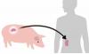 Japan's 1st pig kidney transplant trial eyed as early as 2028