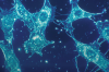Singapore's Biobot Surgical raises $15.5m in funding led by ClavystBio