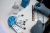 Sexually transmitted diseases: HIV diagnoses fall to five-year low as syphilis cases rise