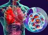 Local researchers expose hidden drug-resistant TB