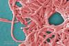 Hamilton legionellosis outbreak over, public health officials say