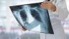 Tuberculosis incidence decreased by 13.1% in Kazakhstan