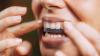 Warning over illegal and unsafe teeth-whitening products