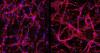 Stem cell breakthrough offers fresh hope for treating blindness