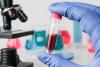 Second Measles Case of 2026 Confirmed by Wyoming Department of Health