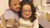 Severe disease causes couple to break over 400 bones: Their story