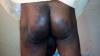 Burundi : NGOs accuse authorities of allowing torture to continue with impunity