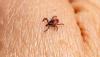 More than 13 thousand cases of tick bites recorded in Kazakhstan since beginning of season