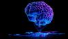 Backed by top-tier VCs, stealthy biotech bags AlzeCure Alzheimer’s asset in $2.2B deal