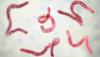 Michigan parasite outbreak infects over 150 people, investigation underway