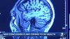 Concussion clinic opens at Oklahoma Children's OU Health