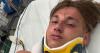 German footballer suffers serious neck injury after diving into hotel pool in Mallorca