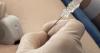 Ukrainian and Polish doctors performed surgery on a child before birth — in the womb