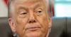 Trump Health Cuts Spark Concerns Over ‘Flesh-Eating’ Bacteria