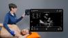 FDA Clears Clarius Ejection Fraction AI to Deliver Objective, Real-Time Cardiac Ultrasound Assessments for Primary Care and Emergency Medicine