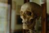 Scientists Find the Grossest, Most Efficient Way to Clean a Skeleton