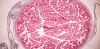 Placenta as property: why every mother deserves the right to choose