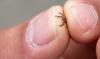 Increase of tick-borne diseases in Illinois highlights the need to prevent tick bites year round