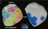 The brain scan that could reveal a cold-blooded killer: Scientists discover key difference in people who commit premeditated murder