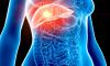 Takeaways and beers: Experts discover the lifestyle choices that trigger most dangerous form of bowel cancer