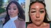I woke up suddenly blinded on a girls holiday – doctors couldn’t identify my infection and I was trapped in Greece