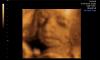 Idaho May Have Abortions Up to Birth Ballot Measure