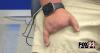 Oklahoma father who lost fingers in fireworks accident shares warning ahead of Fourth of July
