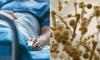 Cases of fungus deemed one of 'the greatest threats to public health' are surging, officials warn