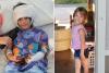 California girl, 7, left ‘fighting for her life’ after pack of dogs rip off scalp, shred legs