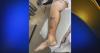 Idaho man bitten twice by rattlesnake at parents' Oroville home, uses over 40 vials of antivenom