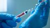 Mpox symptoms with 21 cases confirmed by health officials