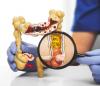 Researchers Identify Promising New Target for Colorectal Cancer Treatment