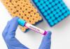 Cases of Legionnaires’ Disease on Manhattan’s Upper East Side jumps to 10: NYC health officials