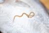 ALERT: New Parasite Causing ‘Explosive’ Diarrhea Across the U.S.