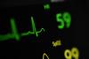 With AI, researchers discover new way to detect sudden cardiac death risk