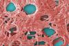 New York Launches Investigation Into Legionnaires’ Disease Community Cluster