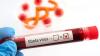 First Ebola patient in France recovers