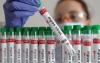 World : Guinea-Bissau Confirms First Mpox Case, Activates Response Mechanisms