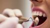 British scientists issue warning over a lesser-known cancer: “It is becoming increasingly common worldwide”