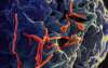 Infectious Disease Roundup: Ebola, West Nile, Hantavirus