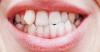 40 Physical Traits That Are Supposedly Ugly But Actually Make People Way More Attractive, According To The Internet