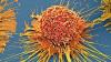 Scientists Wipe Out 99% of Cancer Cells in Lab Using Vibrating Molecules