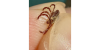 Environmental changes fueling uptick in fleas, ticks for 2026 season