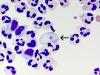 Deadly Brain-Eating Amoeba Season Returns To New York